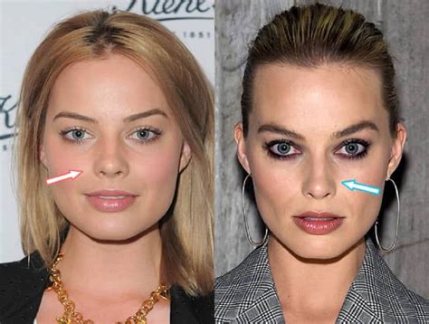 margot robbie before surgery.